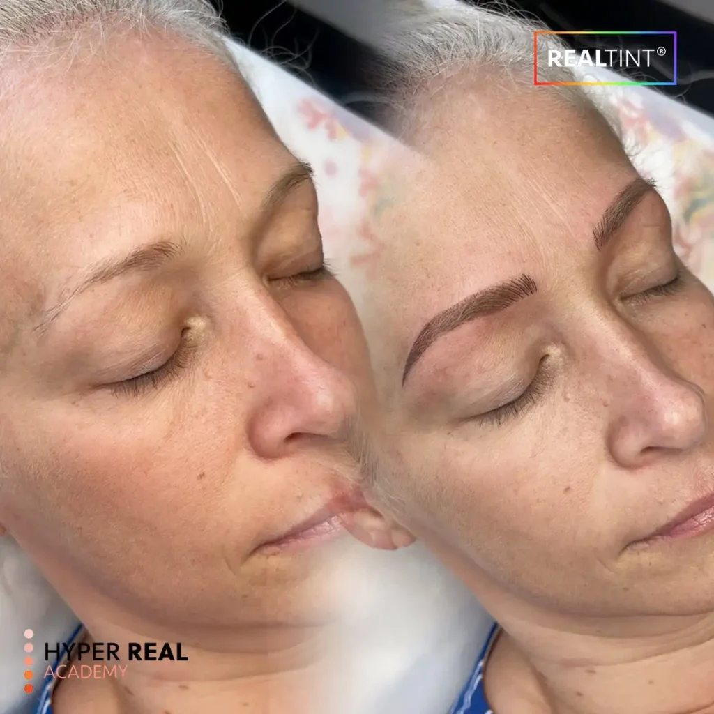 woman before and after brow lift