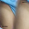Before and after scar camouflage PMU training demonstration by Hyper Real Academy using RealTint pigments.