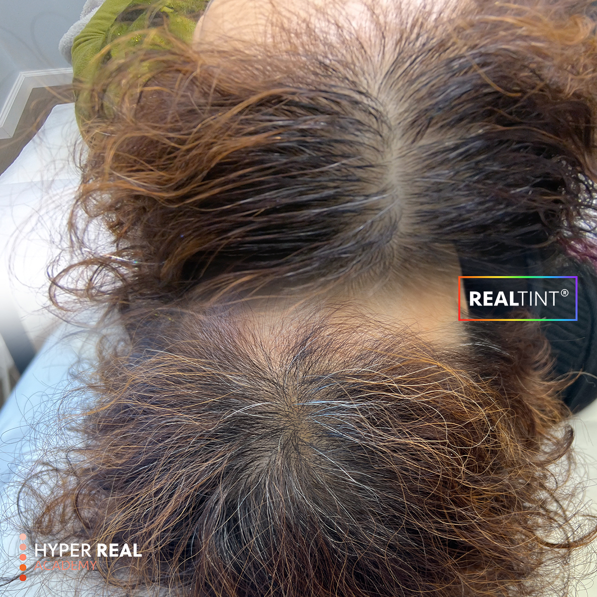 Hyper Real Academy SMP training demonstration showing scalp micropigmentation on thinning hair with RealTint.