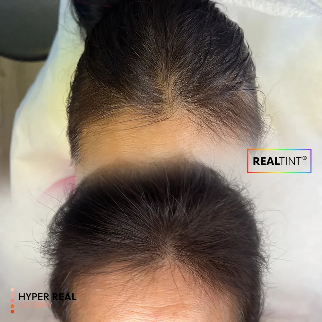 SMP scalp micropigmentation before and after. Hyper Real Academy training demonstration using RealTint pigment.