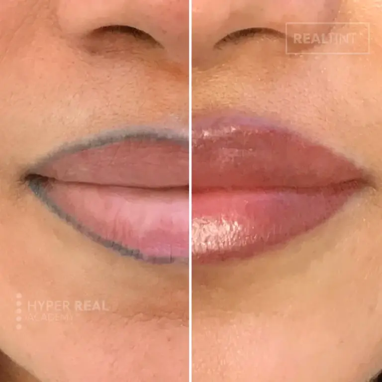 Lip blush healing stage - lips with reddish-pink pigment showing peeling/scabbing texture. Glossy from aftercare ointment. Typical Day 3-7 healing progress documentation.