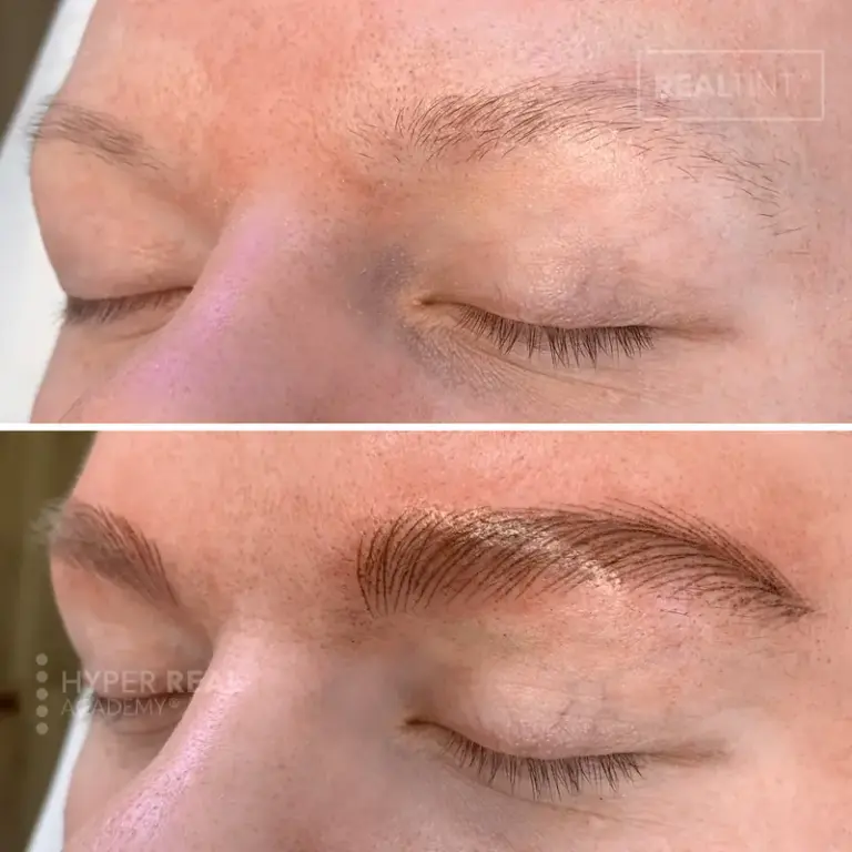 Nano brows with scar camouflage - PMU procedure covering scar tissue with hair stroke technique. Specialized corrective work combining nano brows and scar camouflage.