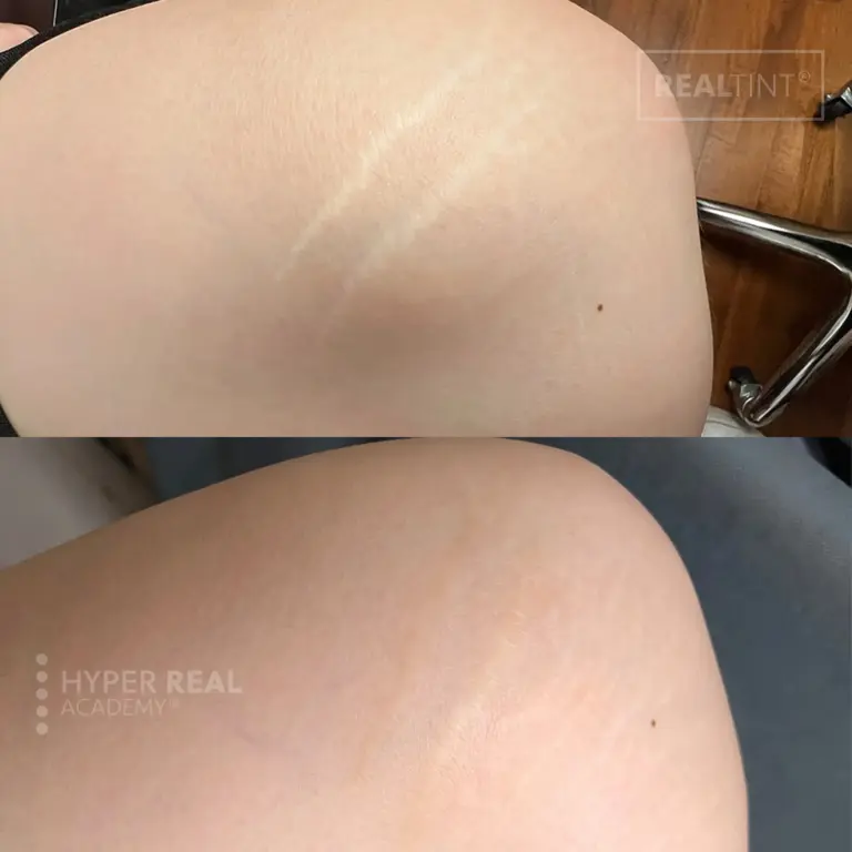 scar camo before and after cover-up completed at Hyper Real Academy
