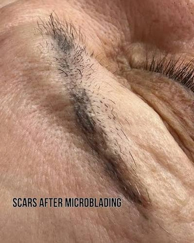 skin injury