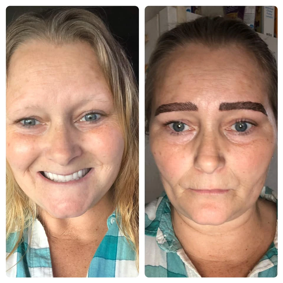 before and after of a terrible eyebrow botch job
